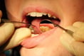 Just a third of Cornwall adults see their dentist during pandemic