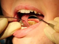 Just a third of Cornwall adults see their dentist during pandemic
