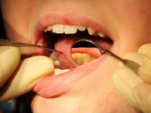 Just a third of Cornwall adults see their dentist during pandemic