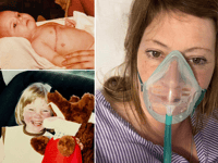 Record number of patients await life-saving organ transplants