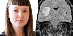 Artist documents her brain tumour health journey