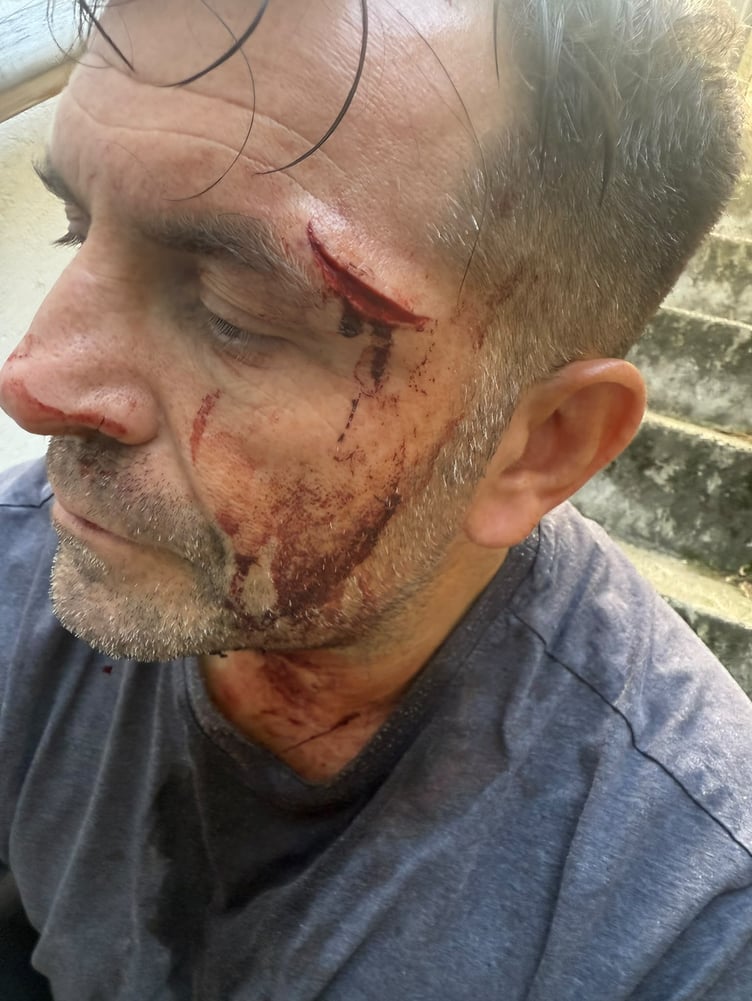 Postermaster Rikki Brandham was left scarred following the alleged attack
